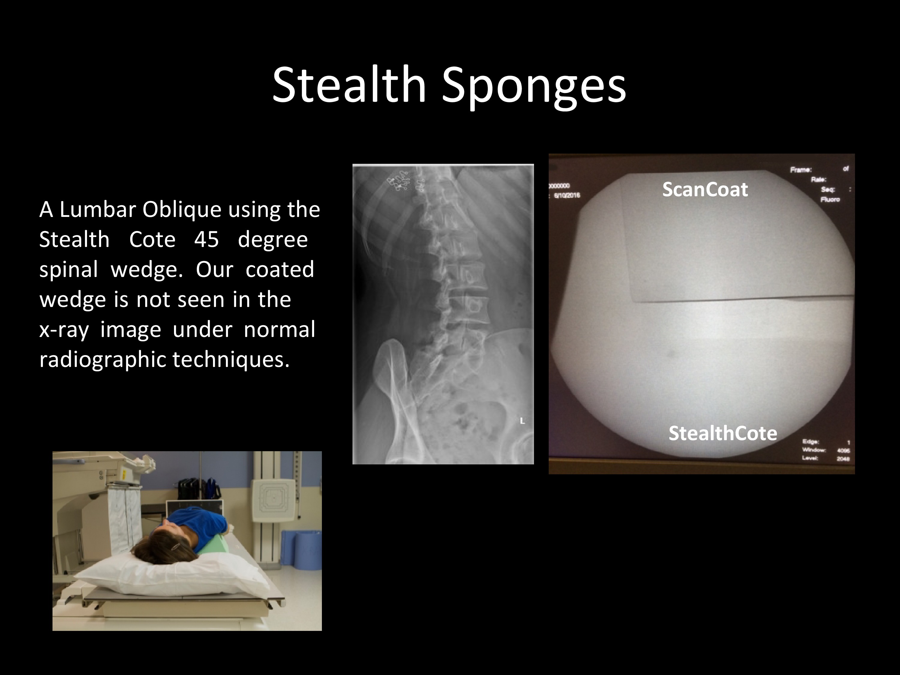 TechnoAide Stealth Core and Stealth Cote Sponges TechnoAide